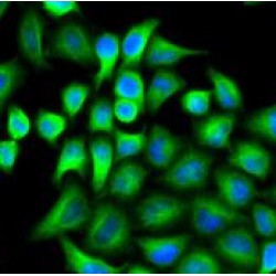 4-Aminobutyrate Aminotransferase (ABAT) Antibody