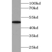 WB analysis of human liver tissue, using ABAT antibody (1/1000 dilution).