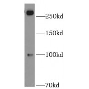 WB analysis of mouse thymus tissue, using ABCA2 antibody (1/500 dilution).