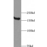 WB analysis of mouse brain tissue, using ABCA8 antibody (1/300 dilution).