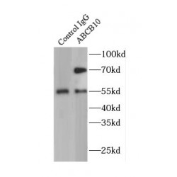 ATP Binding Cassette Subfamily B Member 10 (ABCB10) Antibody