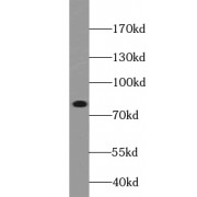 WB analysis of K-562 cells, using ABCB10 antibody (1/500 dilution).