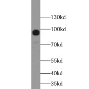 WB analysis of mouse brain tissue, using ABCB6 antibody (1/500 dilution).