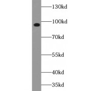 WB analysis of Raji cells, using ABCB6 antibody (1/500 dilution).