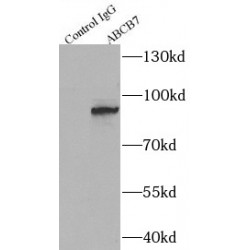 ATP Binding Cassette Subfamily B Member 7 (ABCB7) Antibody