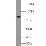 WB analysis of mouse liver tissue, using ABCB7 antibody (1/1000 dilution).