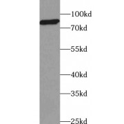 WB analysis of mouse thymus tissue, using ABCB9 antibody (1/500 dilution).