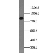 WB analysis of human brain tissue, using ABCD1 antibody (1/300 dilution).