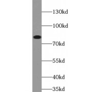 WB analysis of HeLa cells, using ABCD1 antibody (1/1000 dilution).