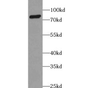 abx230038