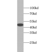 WB analysis of mouse heart tissue, using ABHD1 antibody (1/600 dilution).