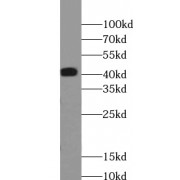 WB analysis of mouse skin tissue, using ABHD12B antibody (1/200 dilution).