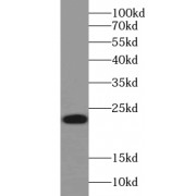 WB analysis of L02 cells, using ABHD14B antibody (1/400 dilution).
