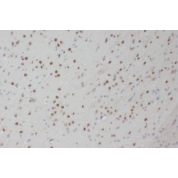 Activator of Basal Transcription 1 (ABT1) Antibody