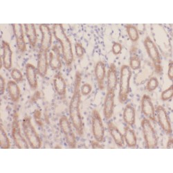Acyl-CoA Dehydrogenase, Long Chain (ACADL) Antibody
