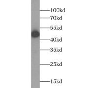 WB analysis of mouse kidney tissue, using ACADL antibody (1/1000 dilution).