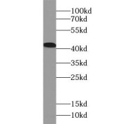 WB analysis of mouse liver tissue, using ACAT2 antibody (1/2000 dilution).