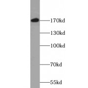 WB analysis of mouse heart tissue, using ACE antibody (1/1000 dilution).