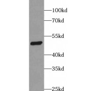 WB analysis of PC-3 cells, using ACPP antibody (1/1000 dilution).