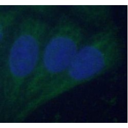 Aconitate Hydratase, Mitochondrial (ACO2) Antibody