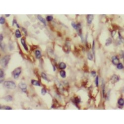 Aconitate Hydratase, Mitochondrial (ACO2) Antibody