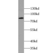 WB analysis of human skeletal muscle tissue, using ACO2 antibody (1/400 dilution).