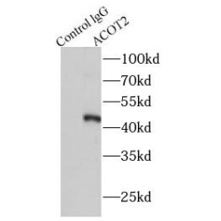 Acyl-CoA Thioesterase 2 (ACOT2) Antibody