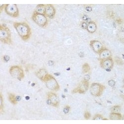 Acyl Coenzyme A Oxidase 1, Palmitoyl (ACOX1) Antibody