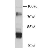 WB analysis of NCI-H460, using AOX antibody (1/1000 dilution).