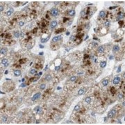 IHC-P analysis of Human liver tissue, using ACOX2 Antibody (1/50 dilution).