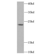 WB analysis of mouse brain tissue, using ACP1 antibody (1/1000 dilution).