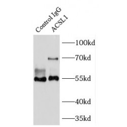 Acyl-CoA Synthetase Long-Chain Family Member 1 (ACSL1) Antibody