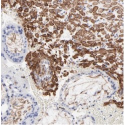 ACSL4 / FACL4 Antibody
