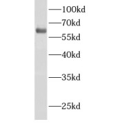 abx230110