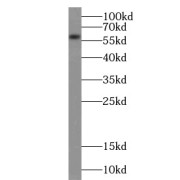 abx230111