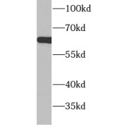 abx230112