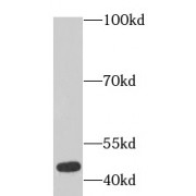 WB analysis of human placenta tissue, using ACTA2 antibody (1/1000 dilution).