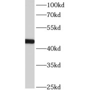 WB analysis of human testis tissue, using ACTL7B antibody (1/300 dilution).