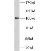 WB analysis of mouse skeletal muscle tissue, using ACTN3 antibody (1/300).