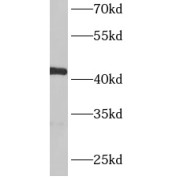 abx230126