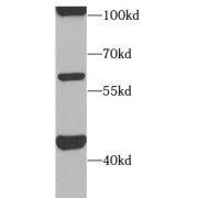 WB analysis of SH-SY5Y cells, using ACVR1C antibody (1/1000 dilution).