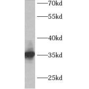 WB analysis of mouse liver tissue, using ACY3 antibody (1/400 dilution).