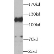 WB analysis of U-937 cells, using ADAM17 antibody (1/1000 dilution).