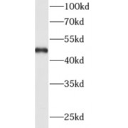 WB analysis of HeLa cells, using ADAM5P antibody (1/1000 dilution).