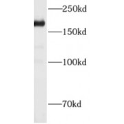 WB analysis of mouse placenta tissue, using ADAMTS12 antibody (1/300 dilution).