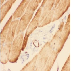 ADAMTS-Like Protein 4 (ADAMTSL4) Antibody