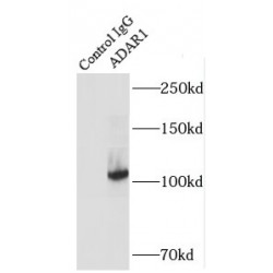 Double-Stranded RNA-Specific Adenosine Deaminase (ADAR1) Antibody