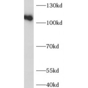 WB analysis of HeLa cells, using ADAR1 antibody (1/1000 dilution).
