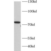 WB analysis of rat brain tissue, using ADARB1 antibody (1/1000 dilution).