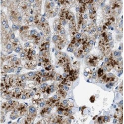 tRNA-Specific Adenosine Deaminase 2 (ADAT2) Antibody